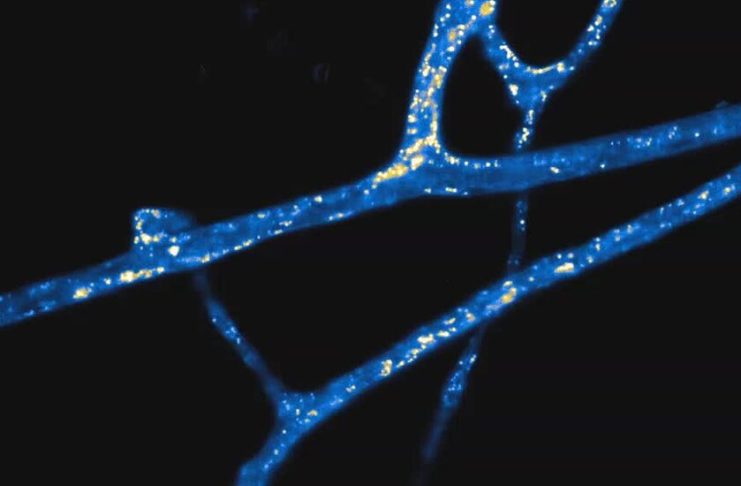 Scientists Measure Earth’s Vast Underground Fungal Webs
